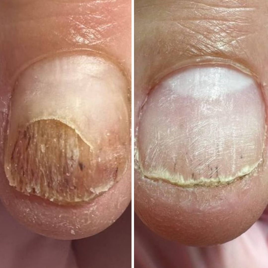 Resultum Onistopix Oil