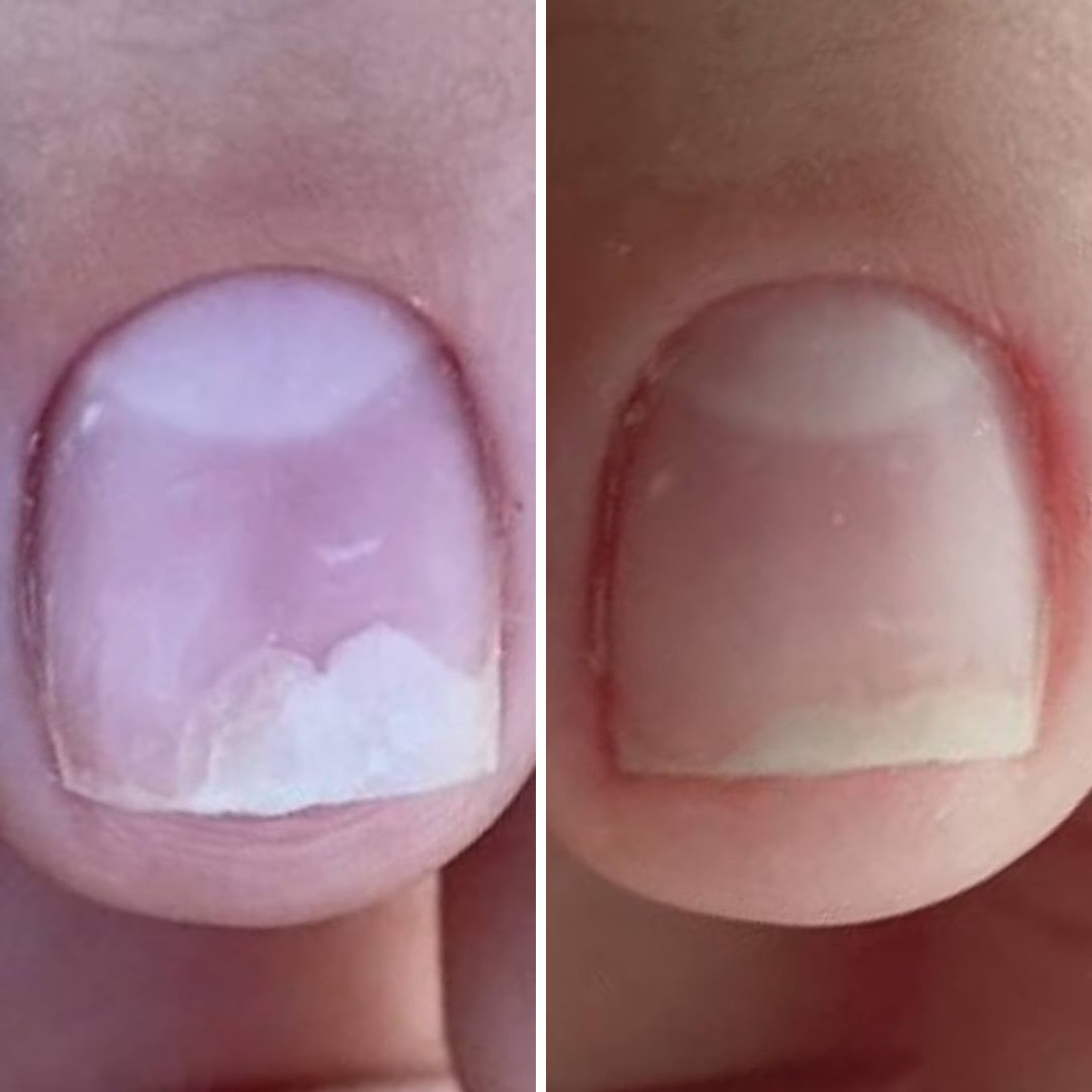 Resultum Onistopix Oil