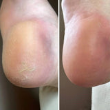 Nails Of The Day Crack Repair Cream for Hands and Feet, 30 ml