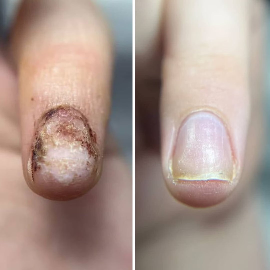 Resultum Onistopix Oil