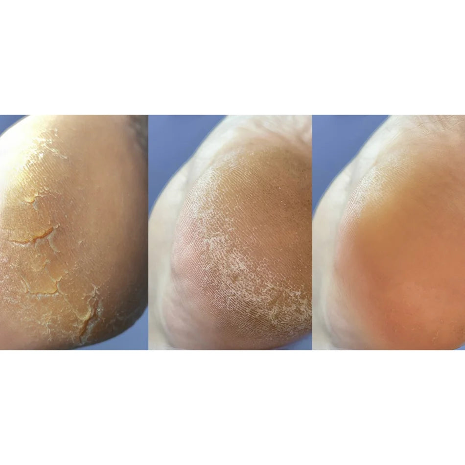 Nails Of The Day Crack Repair Cream for Hands and Feet, 30 ml