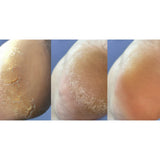Nails Of The Day Crack Repair Cream for Hands and Feet, 30 ml