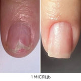 Nails Of The Day Onistop Regenerating Oil Against Onycholysis, 15 ml