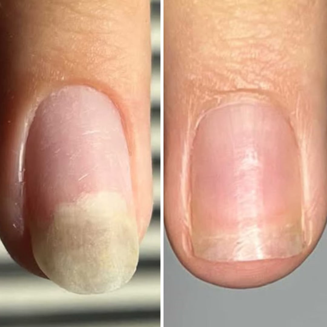 Resultum Onistopix Oil
