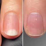 Resultum Onistopix Oil