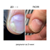 Nails Of The Day Onistop Regenerating Oil Against Onycholysis, 8 ml