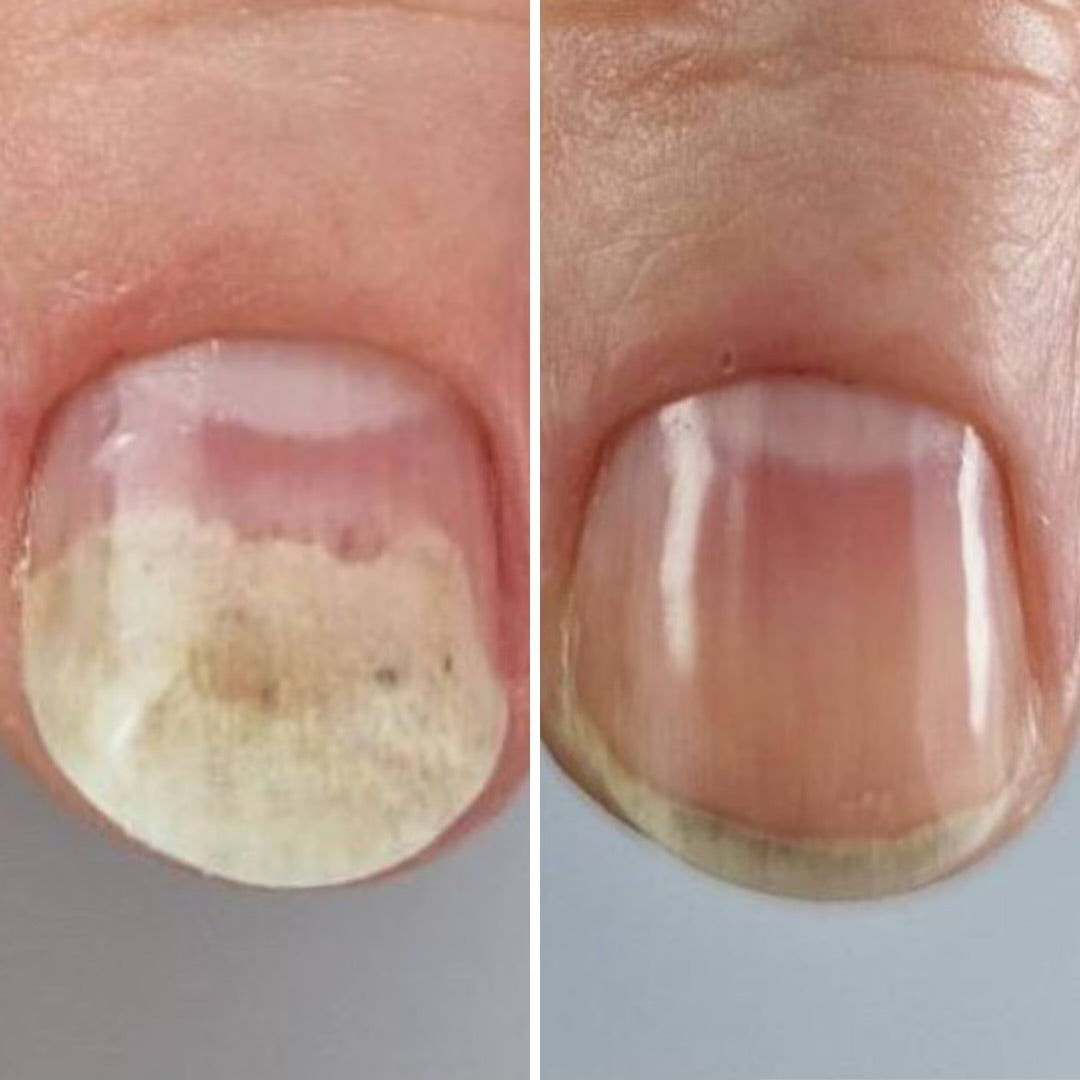 Resultum Onistopix Oil