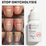 Shelly Oil for damage to the nail plate Stop Onycholysis, 30 ml