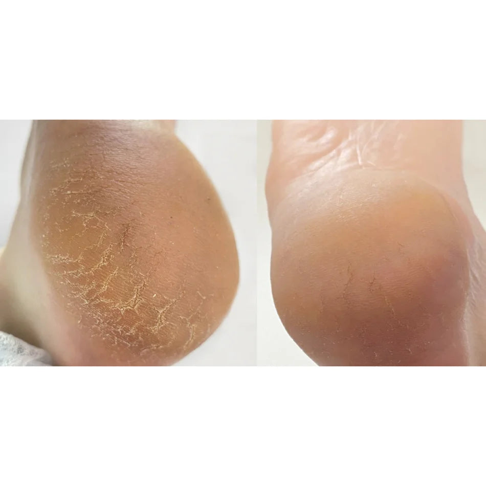 Nails Of The Day Crack Repair Cream for Hands and Feet, 30 ml