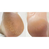 Nails Of The Day Crack Repair Cream for Hands and Feet, 30 ml