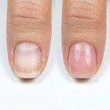Resultum Nail Polish Hardener S.O.S. + Shea Butter, 11 ml (pink)