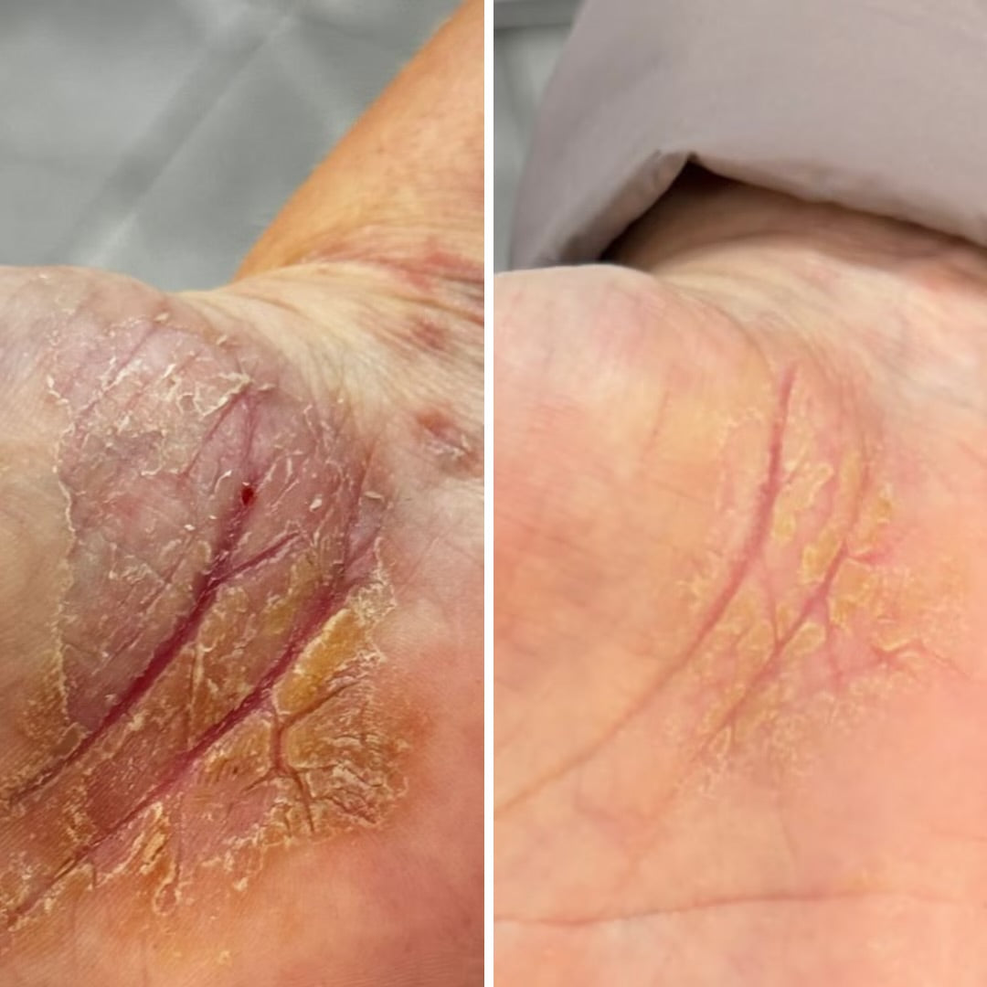 Resultum Soleverum Soap, 75 ml